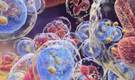 Бронхолегочные осложнения хронических лейкозов