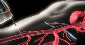 Внутрисосудистые методы исследования в интервенционной кардиологии